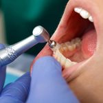 From Baby Teeth to Braces: Pediatric Dentistry in Denver