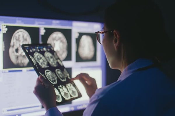 Decoding the Role of MRIs in Diagnosing Back and Spine Issues